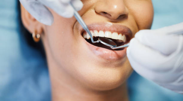  Fortuna, CA Emergency Dentist Pros