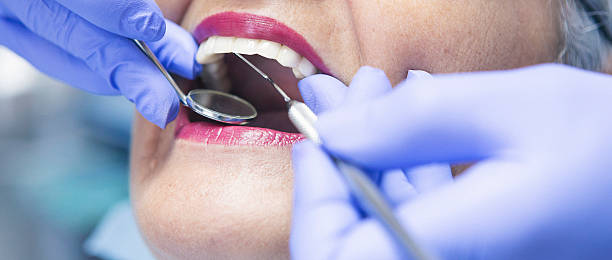 Best Emergency Root Canal Treatment in Fortuna, CA